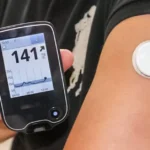 Continuous glucose monitoring sensor showing real-time blood sugar levels for diabetes management