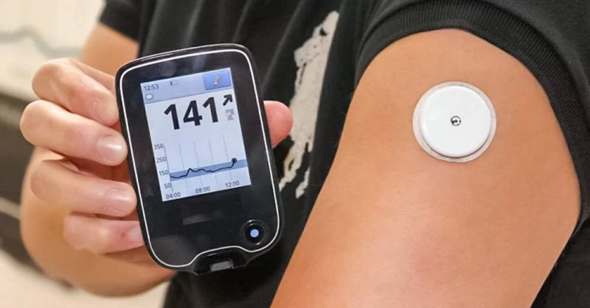 Checking Blood Sugar Doesn’t Have to Be Painful Anymore: Understanding CGM