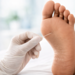 Diabetic Foot Test:| MCR Diabetes & Eye Care, Kannur